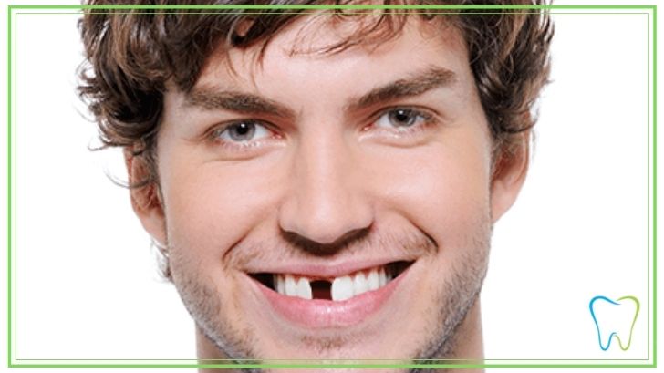 dente mancante dentista ammendolia velletri