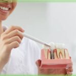 Igiene degli impianti dentali