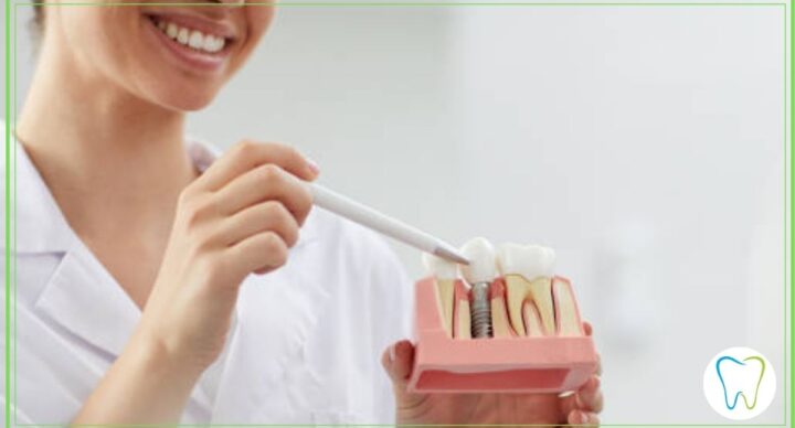 igiene impianti dentali dentista velletri